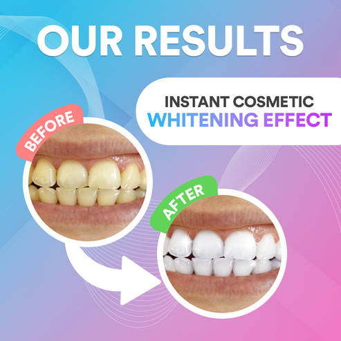 PureSmileTherapy™ Teeth Whitening Pen
